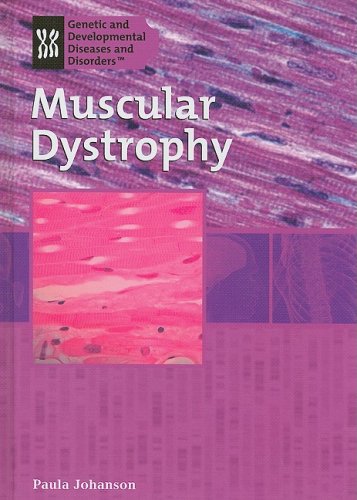 Muscular Dystrophy (Genetic and Developmental Diseases and Disorders)