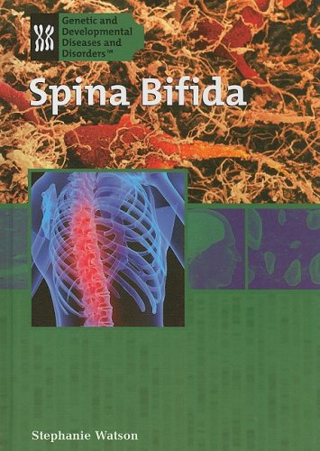 Spina Bifida (Genetic and Developmental Diseases and Disorders)