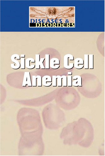 Sickle Cell Disease